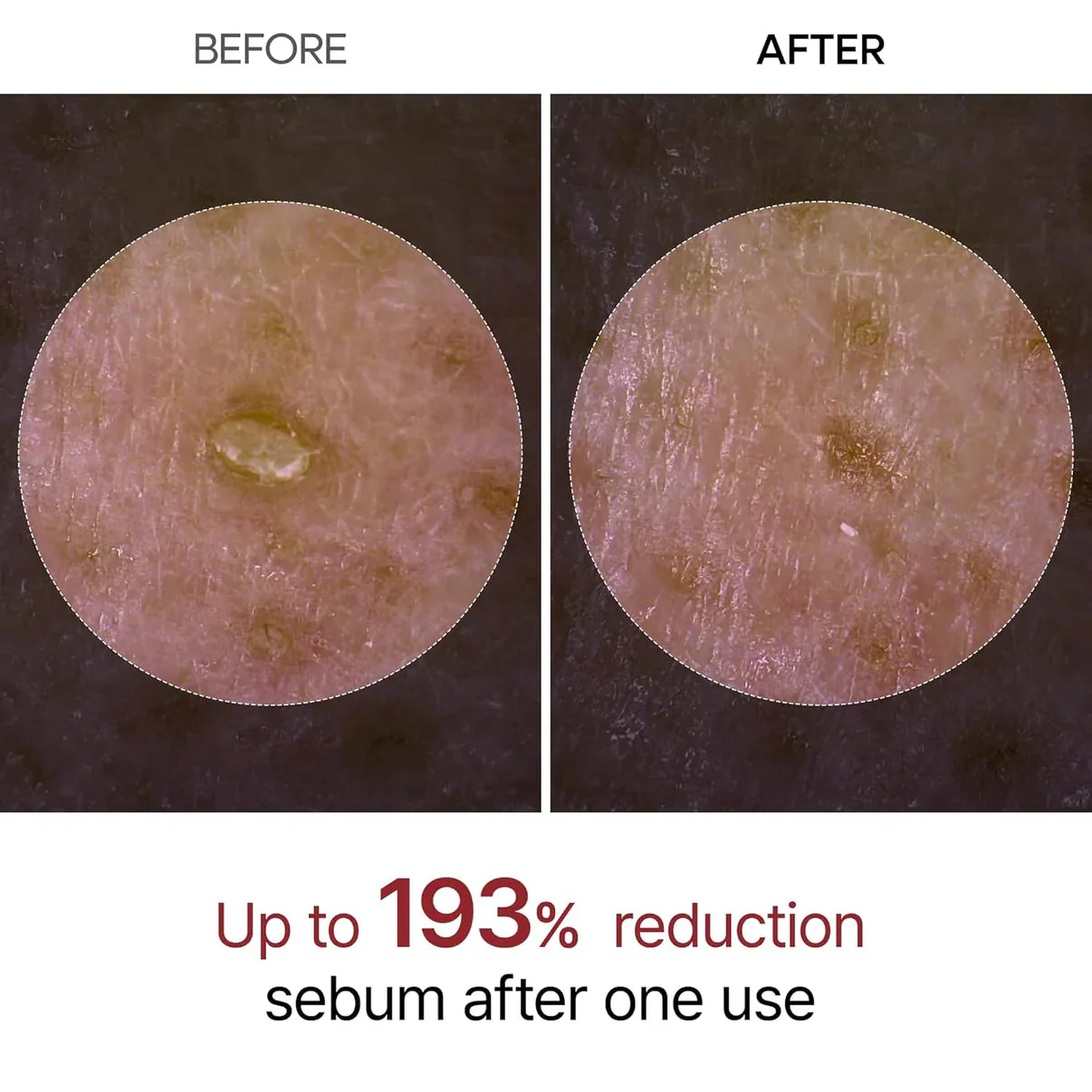 Aloria Rice Peel Serum Ampoule™ - Image 6