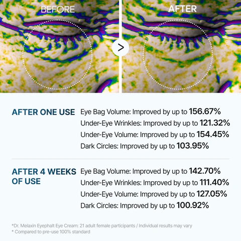 Aloria Eyephalt Eye Cream - Image 6