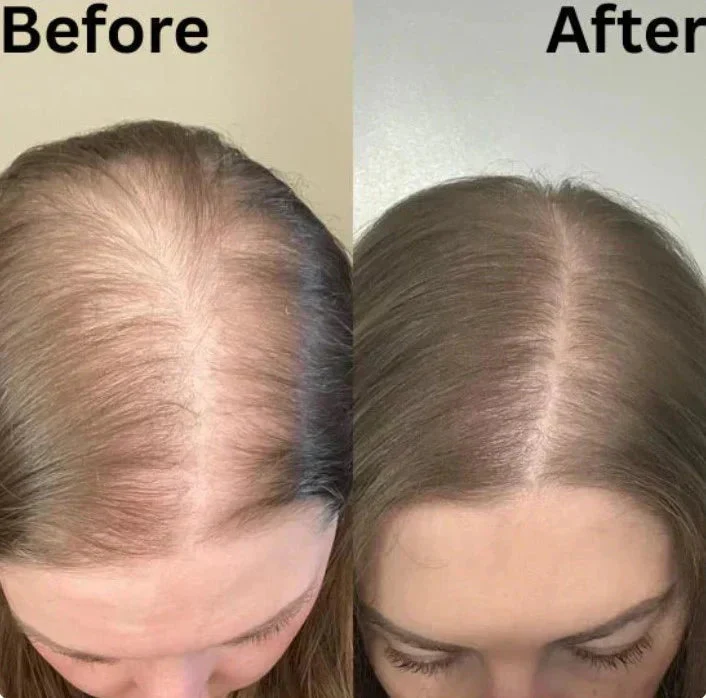 Organic Rosemary Hair Growth Shampoo - Image 9